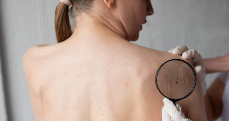 Image of patient undergoing a skin cancer check